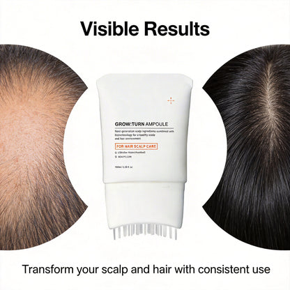 Scalp Renewal Serum — K-Beauty Hair Care Technology