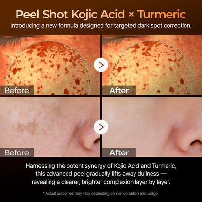 Radiance Peel Shot Spray - Dark Spot Corrector & Glow Booster